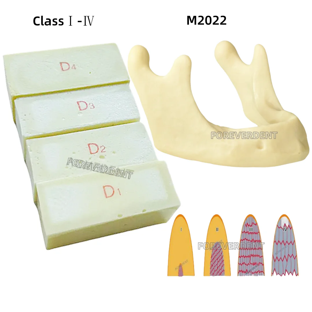 Зубная альвеолярная копия кости с низкой челюстью имплантат полимерные блоки