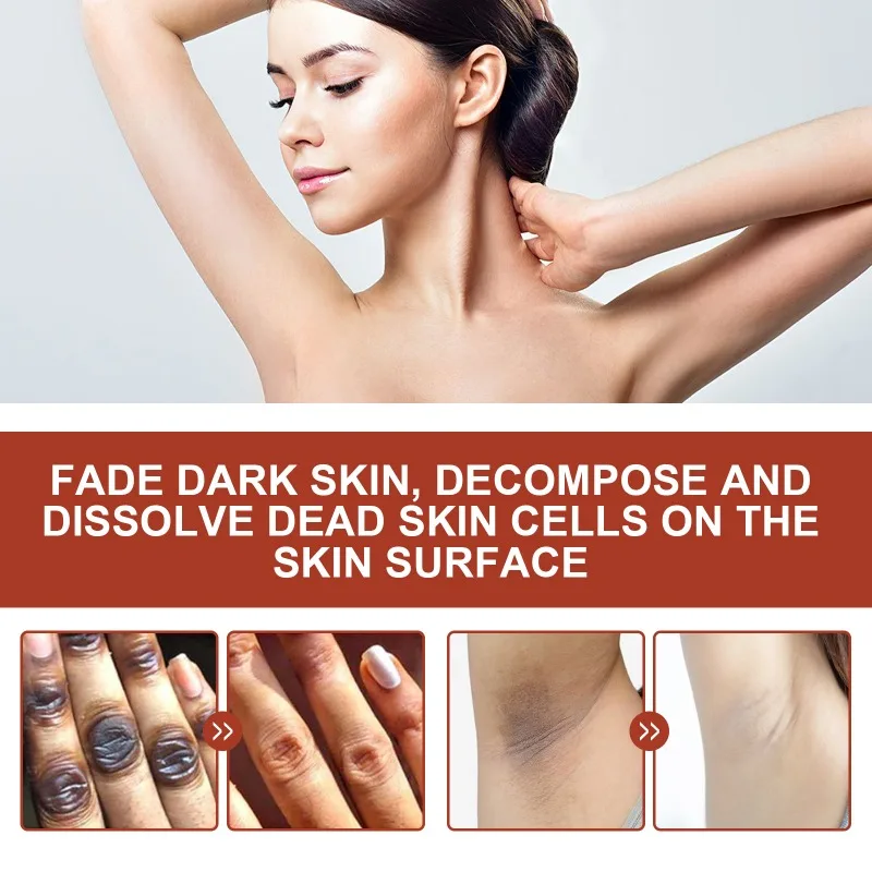 Масло-пилинг Acanthosis Nigricans Органическая отбеливающая Сыворотка для темной кожи