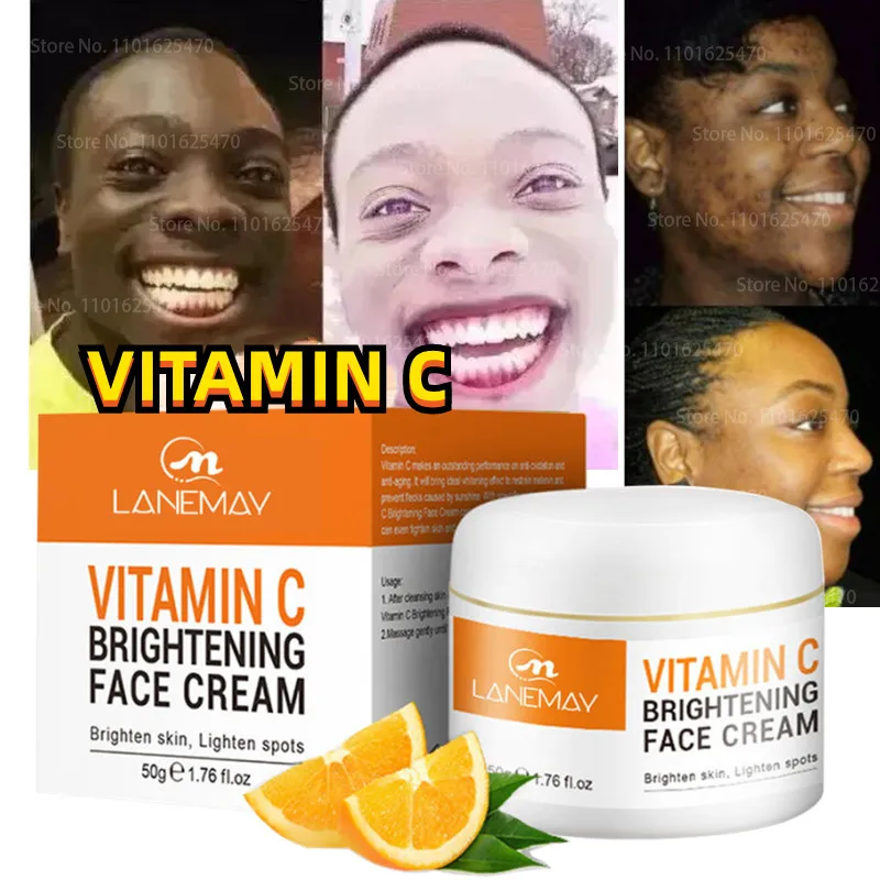 

50ml Face Vitamin C Skin Whitening Cream and Brightening Inhibiting Melanin Anti-aging Acne-removing Facial Skin Care Products