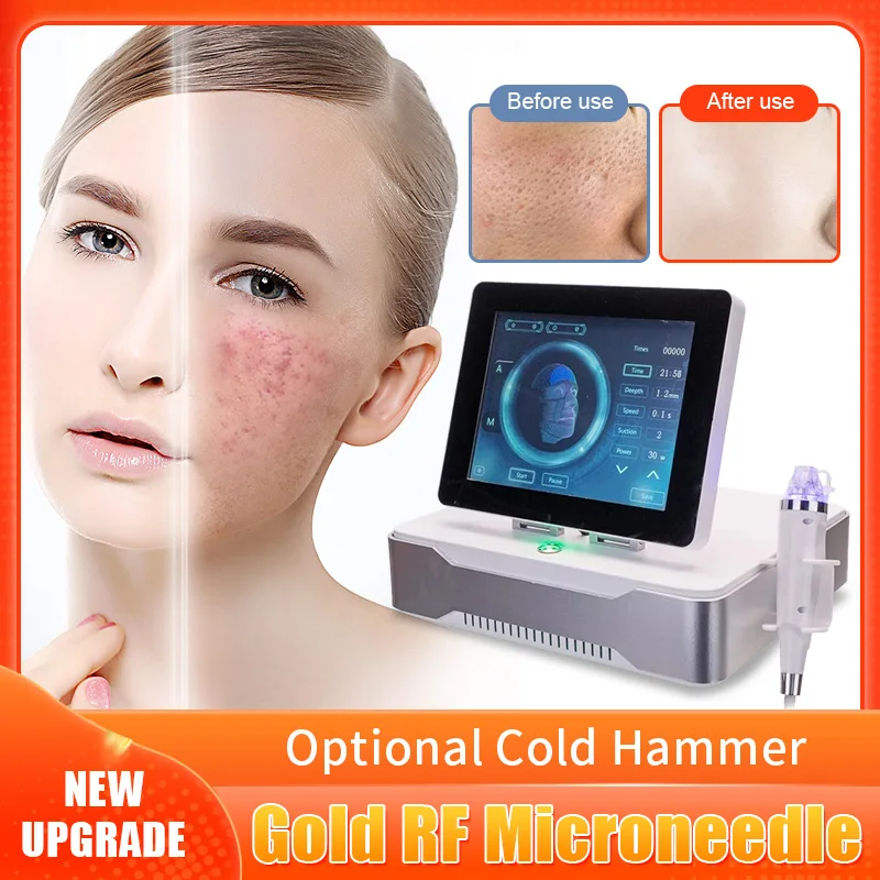 

2022 NEW Portable Microneedling RF Fractional Microneedle Machine Acne Treatment Face lift Skin Rejuvenation Beauty Euipment CE