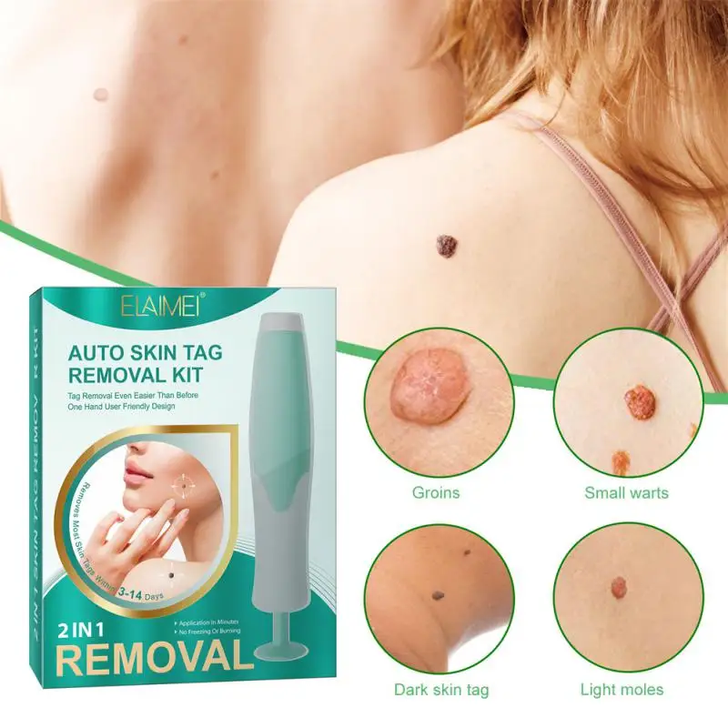

58PCS Auto Skin Tag Remover Painless Mole Wart Remover Skin Tag Removal Kit With Cleansing Swabs Facial Beauty Tool Home Use