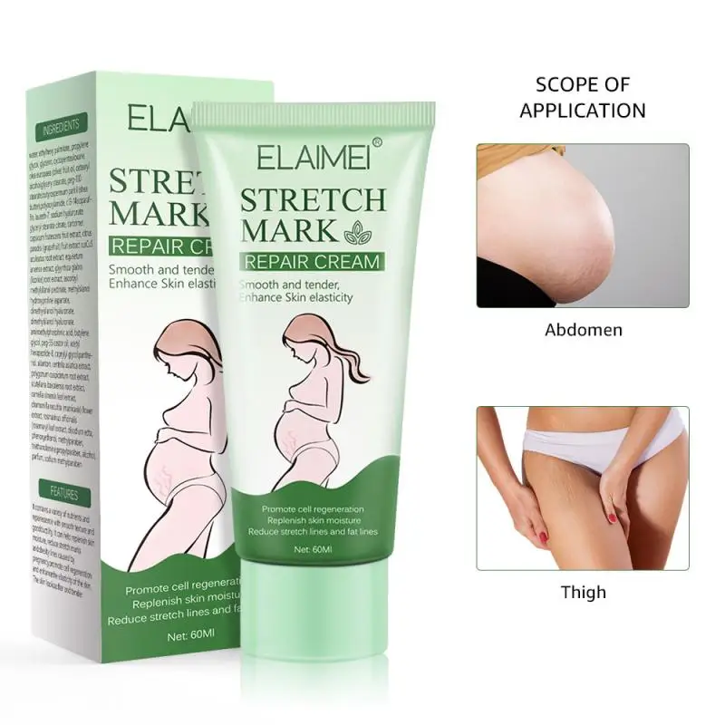 

Stretch Marks Remover Essential Oil Skin Care Stretch Mark Removal Maternity Slackline Scar Obesity Maternity Body Removal TSLM1