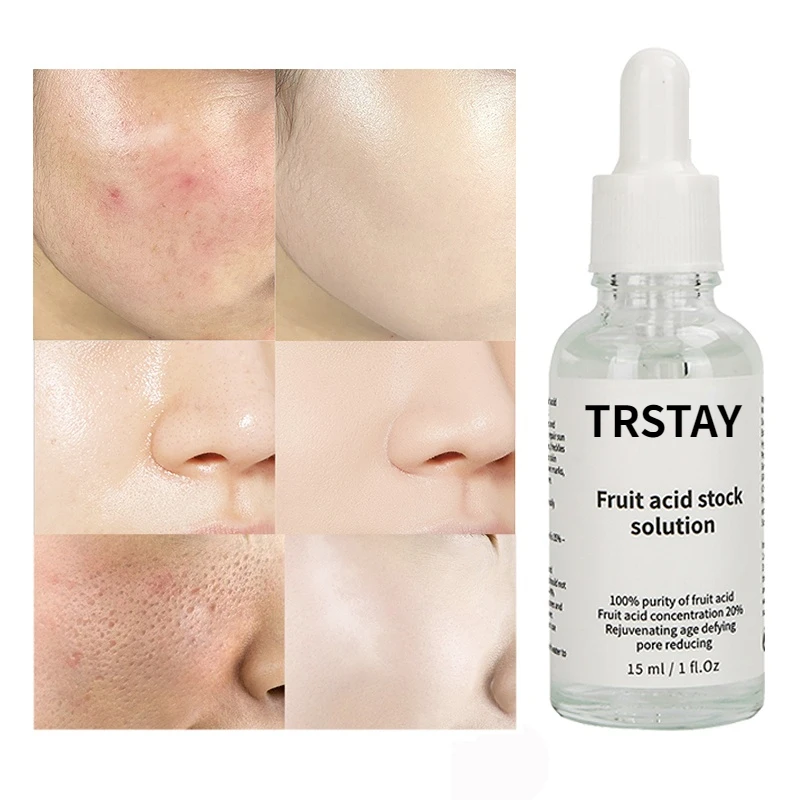 

20%Glycolic Acid Oil Liquid Anti Wrinkles Face Cream Whitening Skin Care Anti-Aging Serum skin care products with free shipping