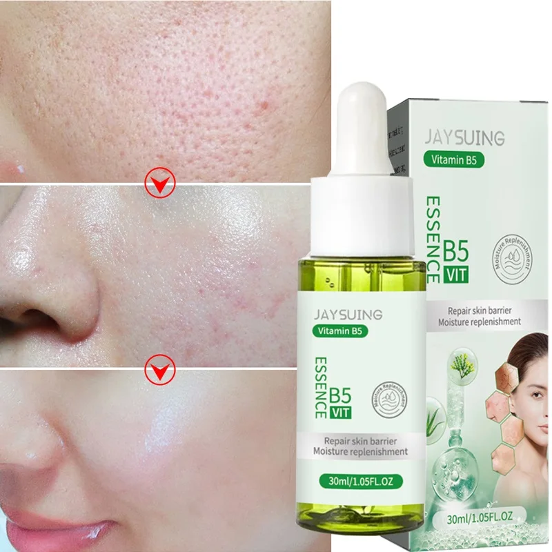 

30ml Vitamin B5 Face Serum Sooth Redness Repair Skin Barrier Moisturizing Anti Acne Shrink Pores Oil Control Essence Beauty Care