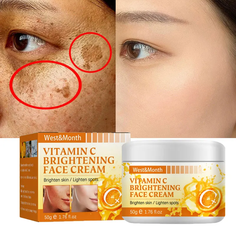 

Vitamin C Whitening Freckles Cream Effective Remove Melasma Dark Spots Lighten Melanin Brighten Skin Anti-aging Face Products