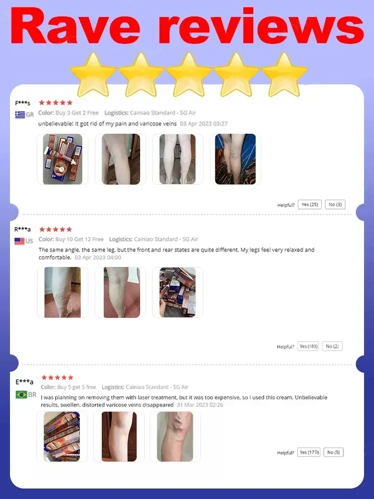 Крем против варикозного расширения вен вариусы салеп Penghilang васкутис Obat Salep крем