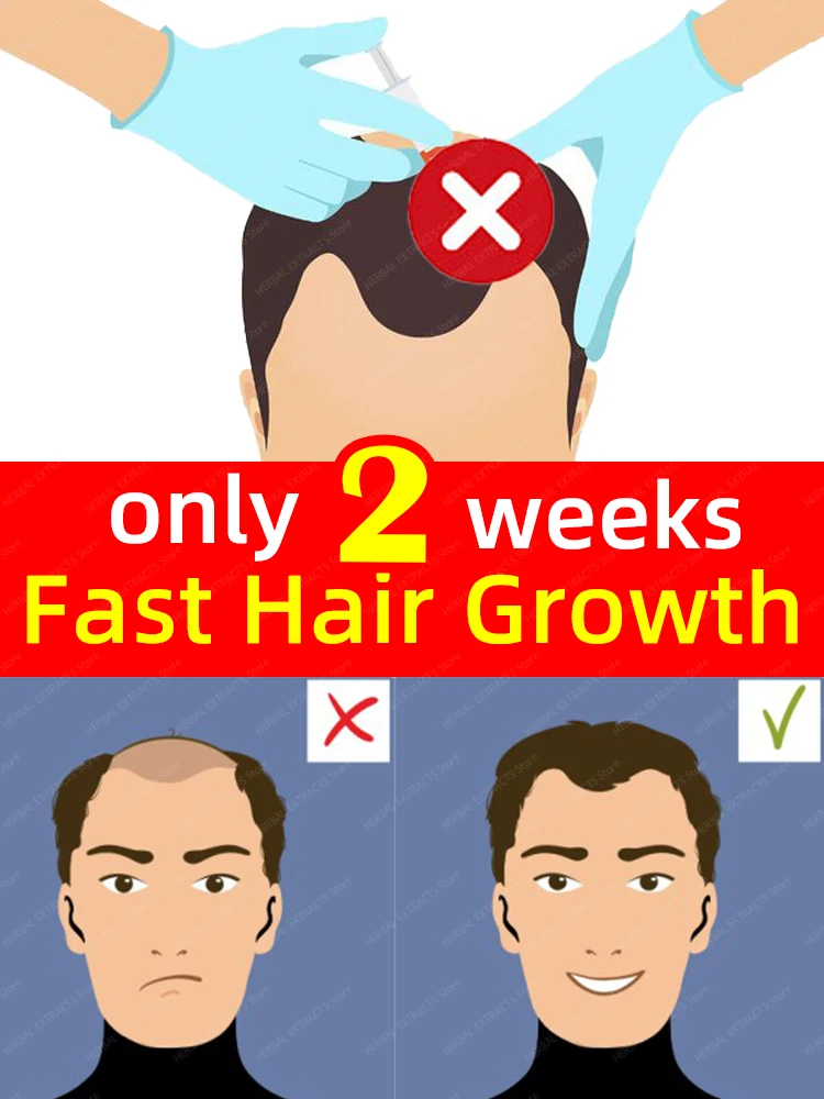 

Масло для роста волос для мужчин, сыворотка для быстрого лечения облысения