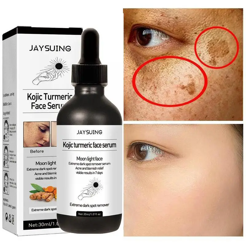 

Turmeric Whitening Freckles Face Serum Remove Dark Scar Melasma Lighten Spots Essence Brighten Anti-aging Acne C9H6