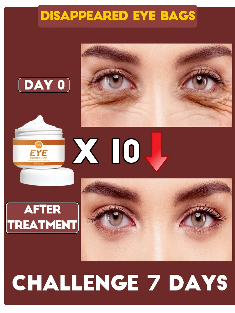 Проблемы для решения вокруг области глаз