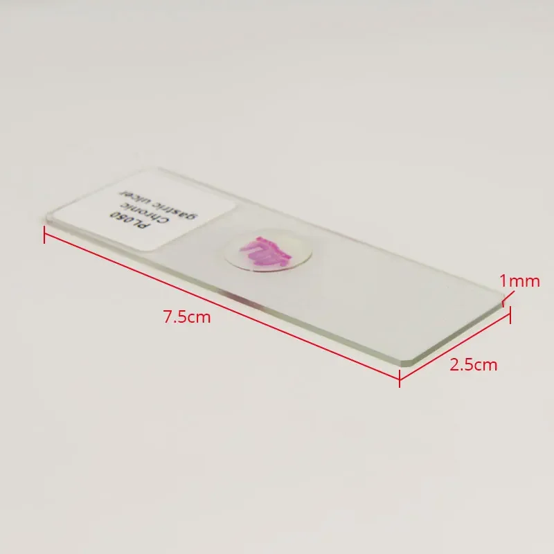 100 видов медицинских патологических секций человеческого тела типовые