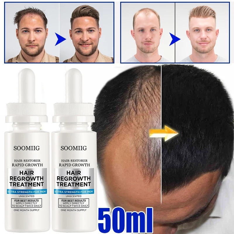 

Ginger Hair Growth Essential Oil Serum Hair Treatment Anti Lost Beauty Products Fast Grow Repair Scalp Frizzy Damaged Hair Care