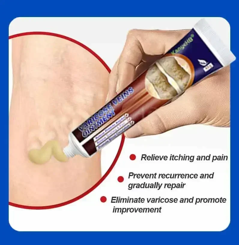 Мазь от варикозных заболеваний Мужская устройство для снятия симптомов боли в