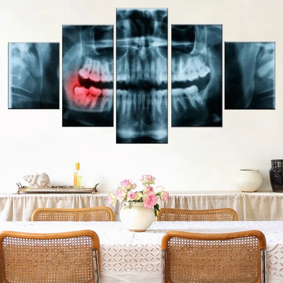 

Unframed 5 Pcs Panoramic Dental X Ray Teeth Clinic Dentist Paintings Canvas Picture Wall Art Posters for Living Room Home Decor