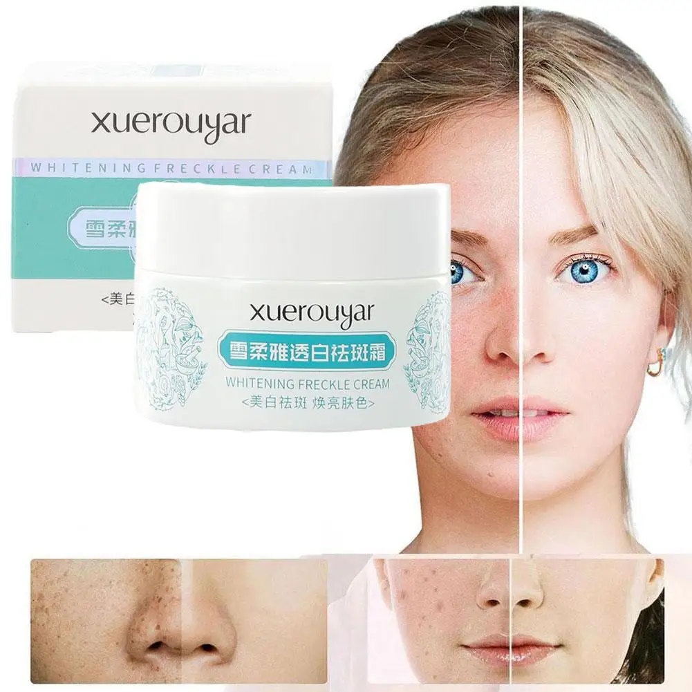 

30g White Spot Cream Fade Speckle Remove Freckle Acne Care Spots Moisturizing Face Beauty Dark Skin P2O8