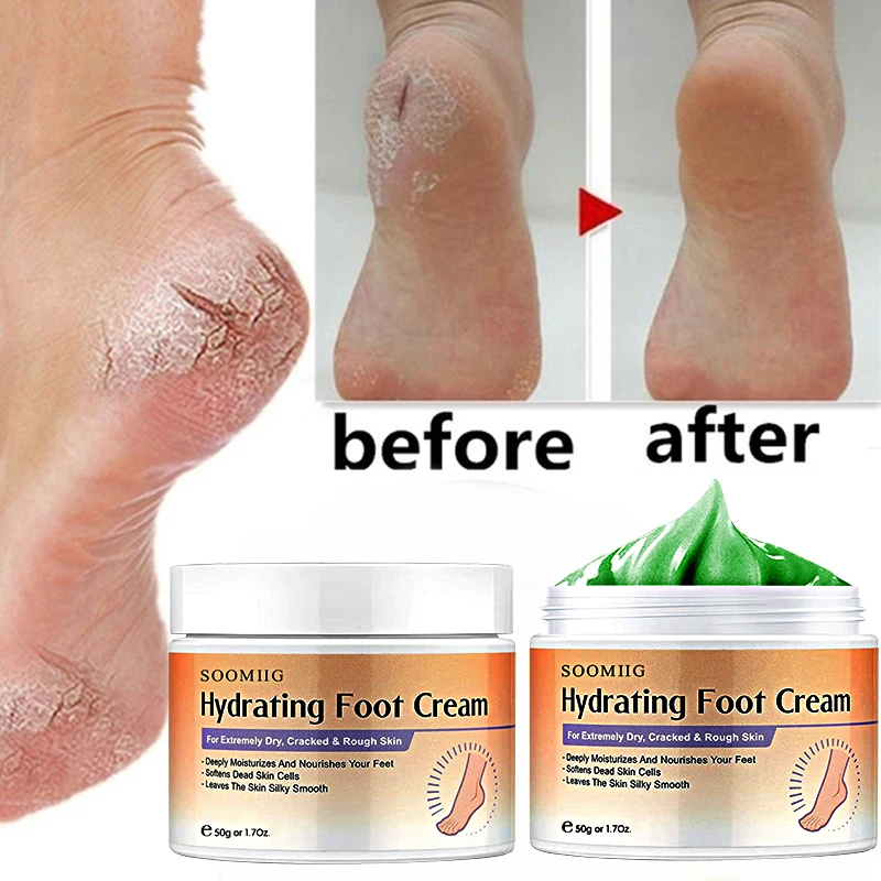 

Cracked Heel Balm Cream For Rough Dry & Cracked Chapped Hand/Feet Heel Skin Care Cream Natural Essence