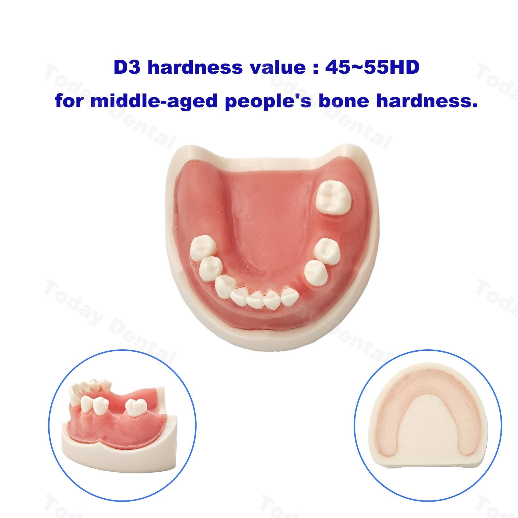 Зубной имплантат модель зубов тренировочная для дантиста Студенческая