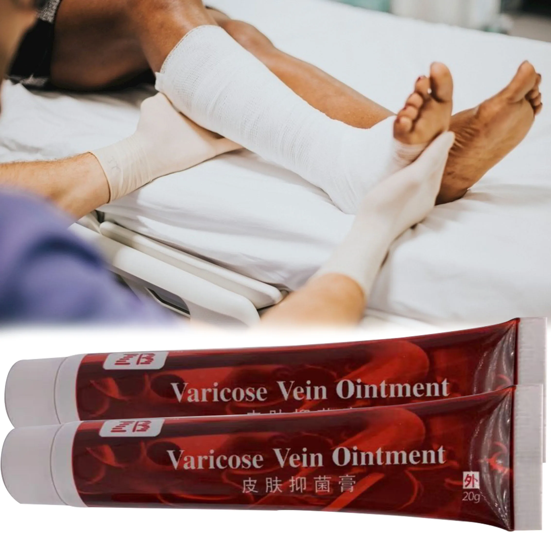

20g ZB New Products Varicose Vein Ointment Varicose Veins Foot Cream Earthworm Legs Remove Lower Extremity Swelling Relief