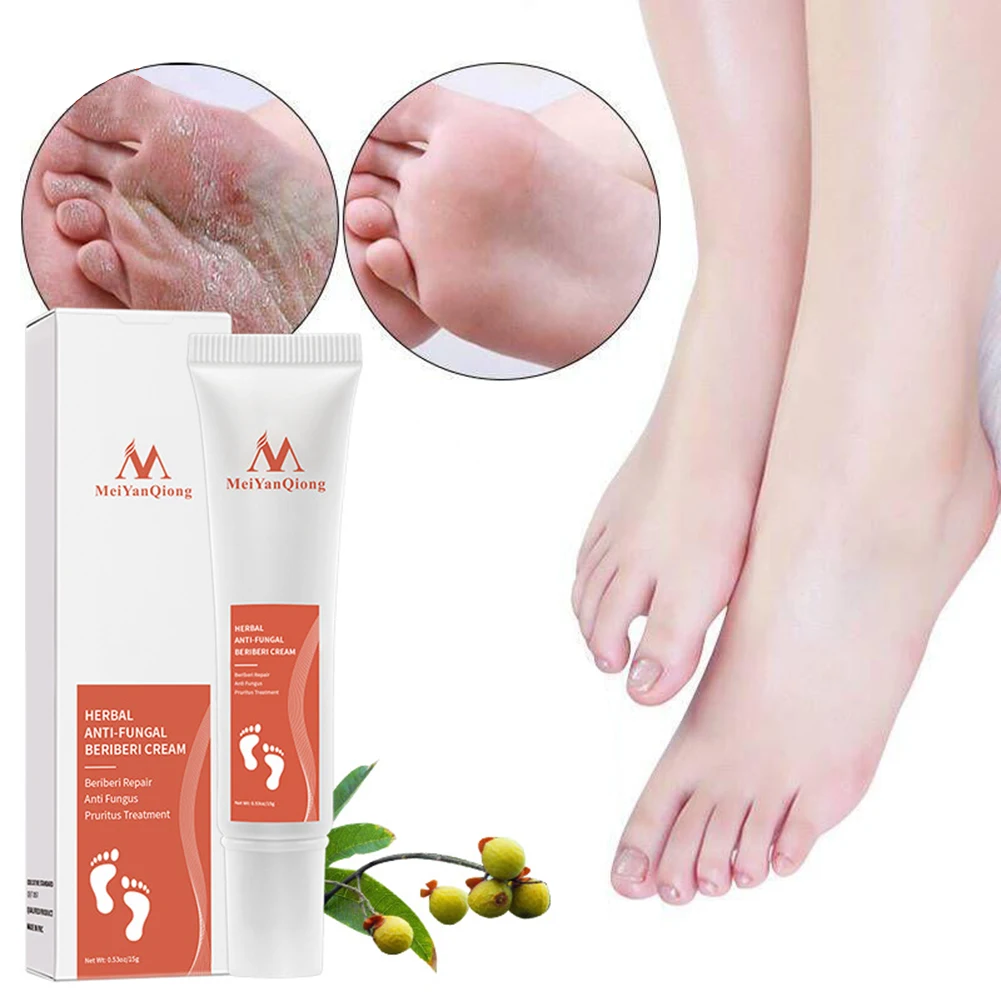 

Herbal Anti Fungal Beriberi Foot Cream Treatment Onychomycosis Paronychia Toe Fungus Gel Repair Dry Crack Feet Care