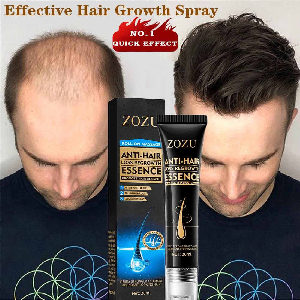 

Fast Growth Hair Essential Oil Natural Anti Hair Loss Prevent Hair Dry Frizzy Damaged Repair Scalp Hair Follicle Care Men Women