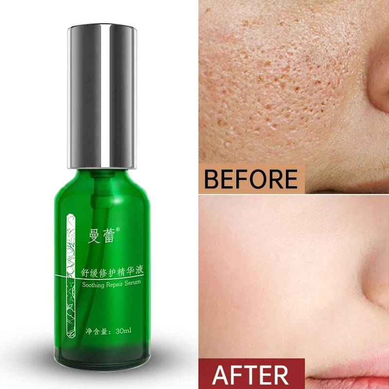 

30ml Soothing Serum Anti-Wrinkle Lifting & Firming Hyaluronic Acid Hydration & Moisturizing Thickening Stratum Corneum