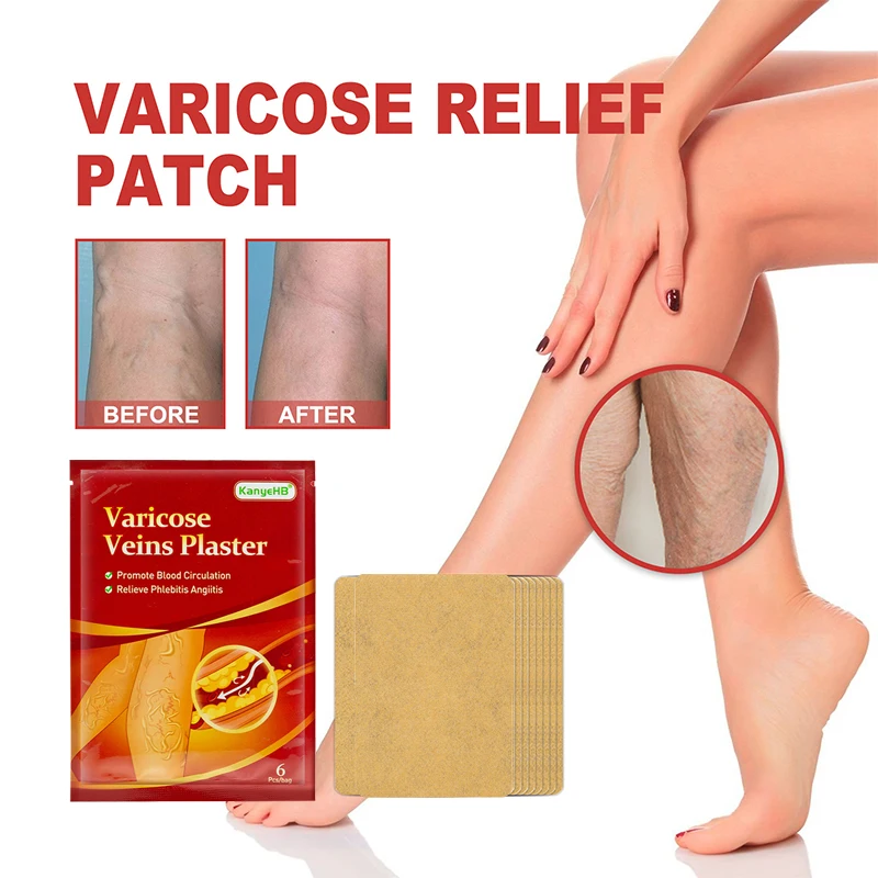 

6PCS Varicose Veins Stickers Promoting Blood Circulation Varicose Vein Healing Patch Medical Patch Skin Care Pain Relief