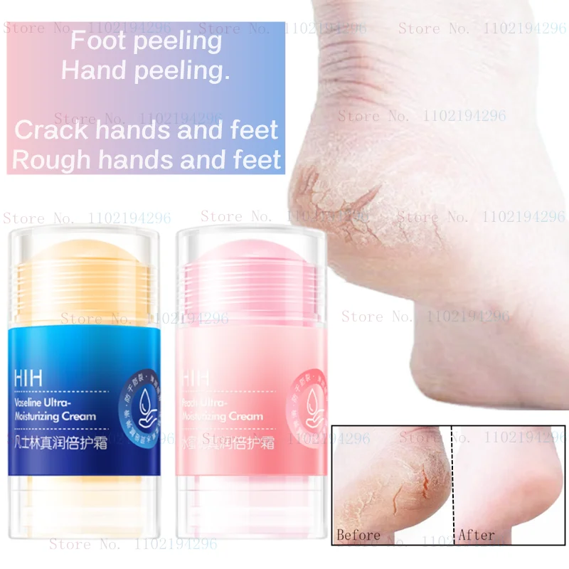 

Vaseline Peach Double Care Cream Moisturizing Stick Anti-chapped Hand Care Foot Cream Heel Nourishment In Autumn and Winter