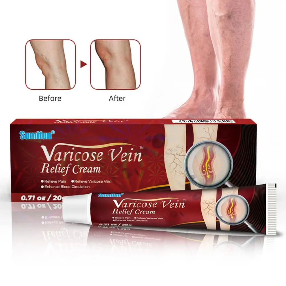 

Ointment Varicose Veins Relief Relieve Leg Bulging Calf Swelling Vasculitis Phlebitis Spider Pain Treatment Massage Cream