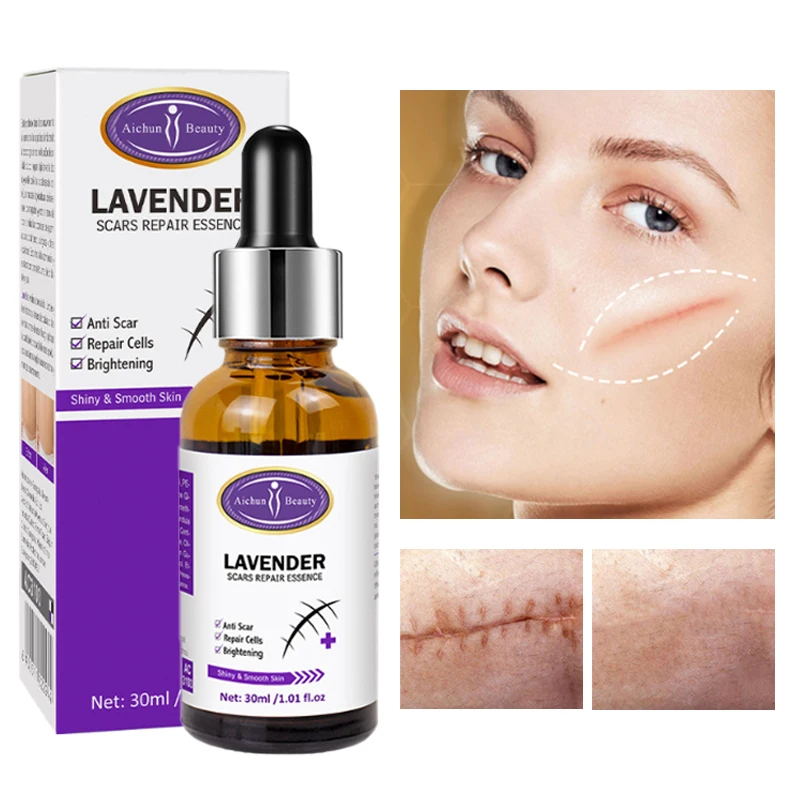 

Scar Repair Serum Scar Treatment Surgical Scars Burns Skin Trauma Acne Imprints Stretch Marks Fade Pigmentation Skin Care 30ml
