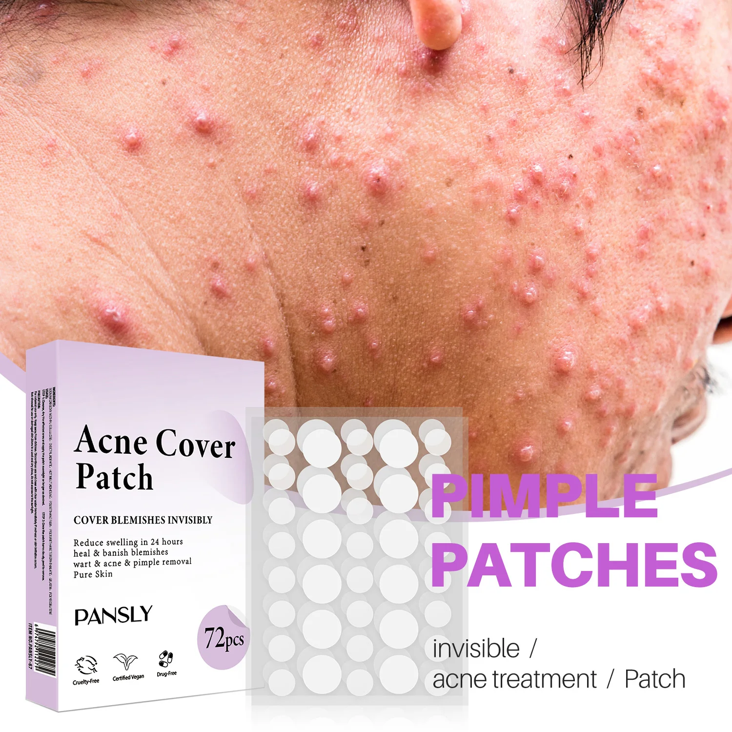 

72 Patches Waterproof Acne Pimple Patch Stickers Acne Treatment Pimple Remover Tool Invisible Breathable Acne Patch Facial Care