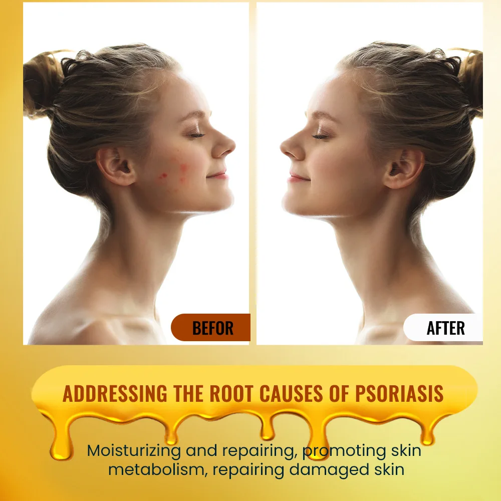 Крем от боли в плечах и суставах Beevenom 28 видов