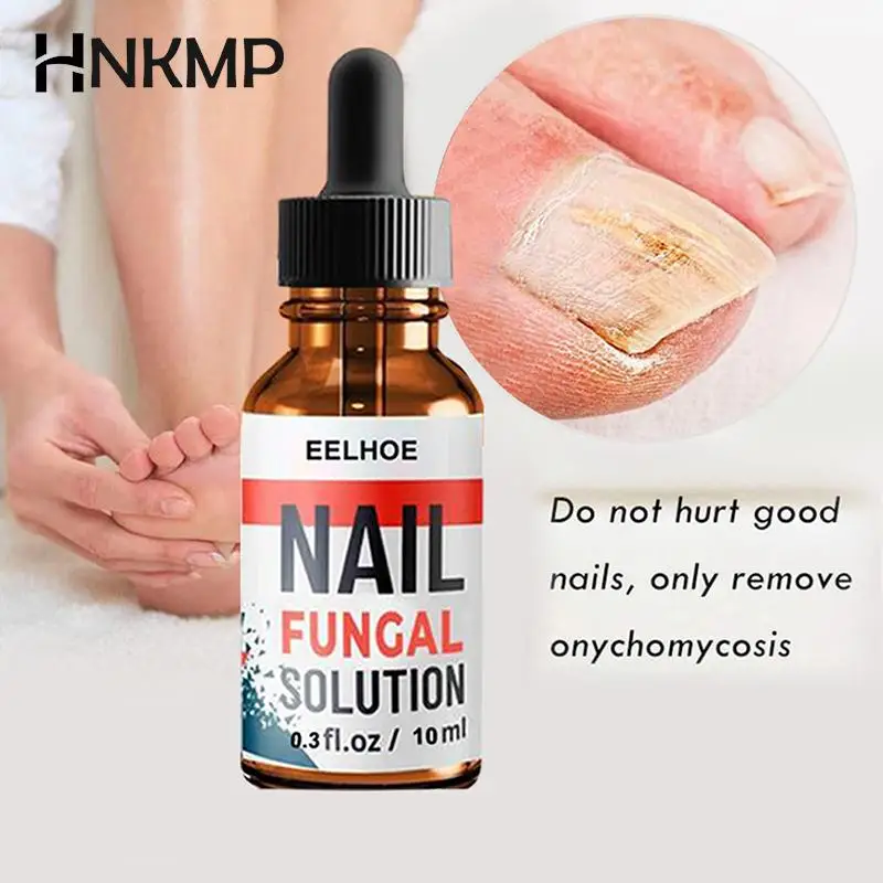 

10/20/30 мл грибковая эссенция для восстановления ногтей, гель для удаления грибка, сыворотка для ухода, лечение ног, противоинфекционный онихо...