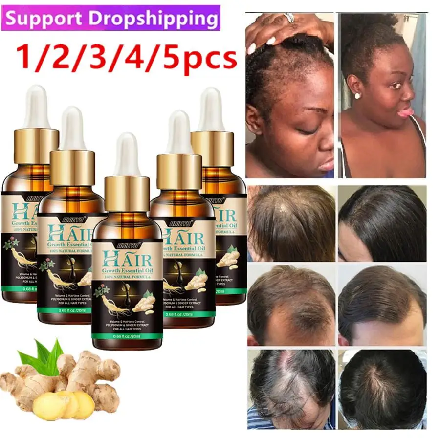 

Lot 7 Days Ginger Products Natural Anti Hair Loss Prevent Baldness Treatment Fast Growing Nourish Dry Damaged Hair