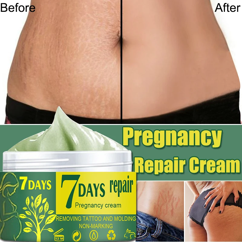 

Эффективный крем для Удаления растяжек, средство от морщин и старения кожи тела