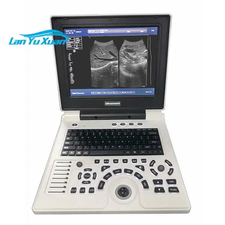 

XF30B Fetal Biometrics Phantom Mobile Scanner Therapy Ultrasound Equipment
