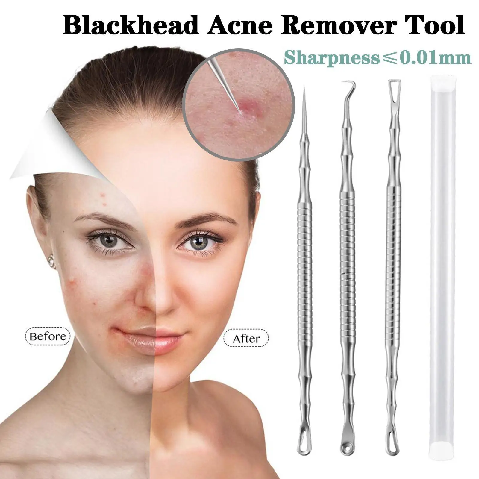 

Набор инструментов для удаления чёрных точек и прыщей, из нержавеющей стали