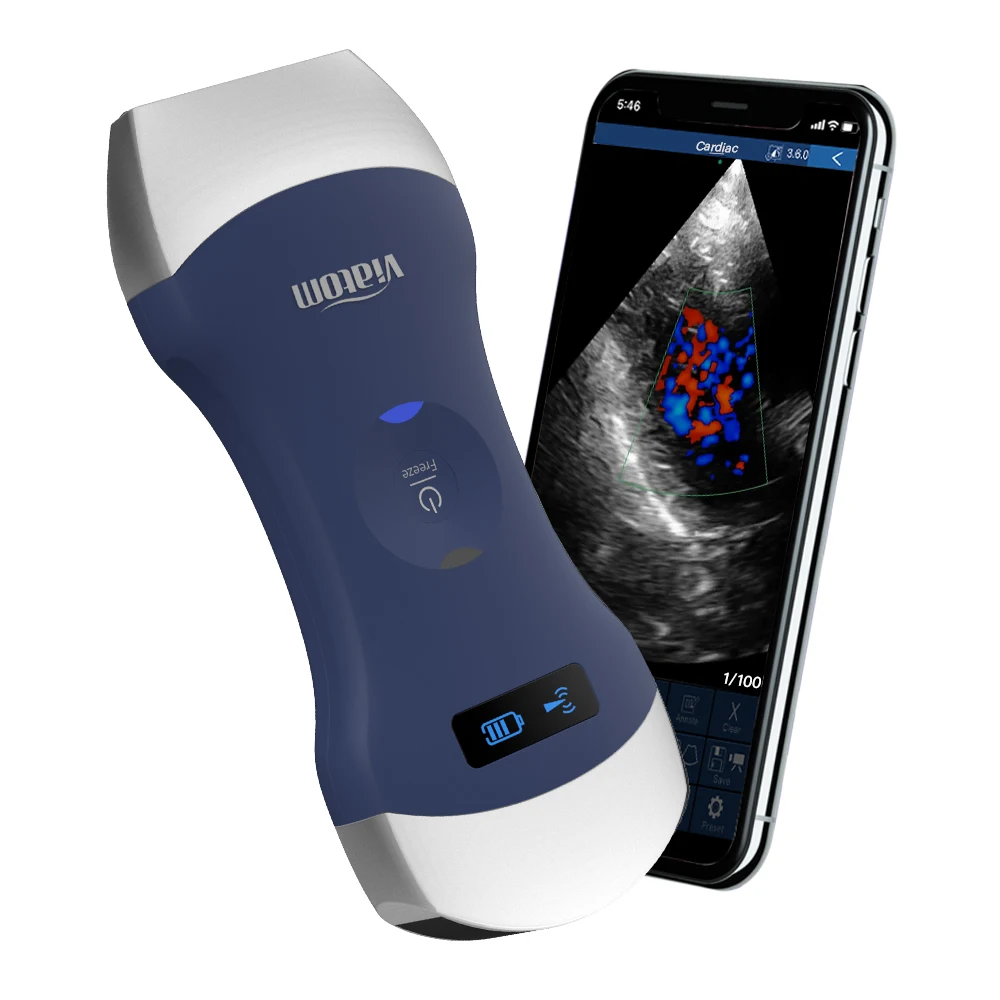 

Viatom Wifi Probe Cardiac Physiotherapy Scanning Machine Portable Ultrasound
