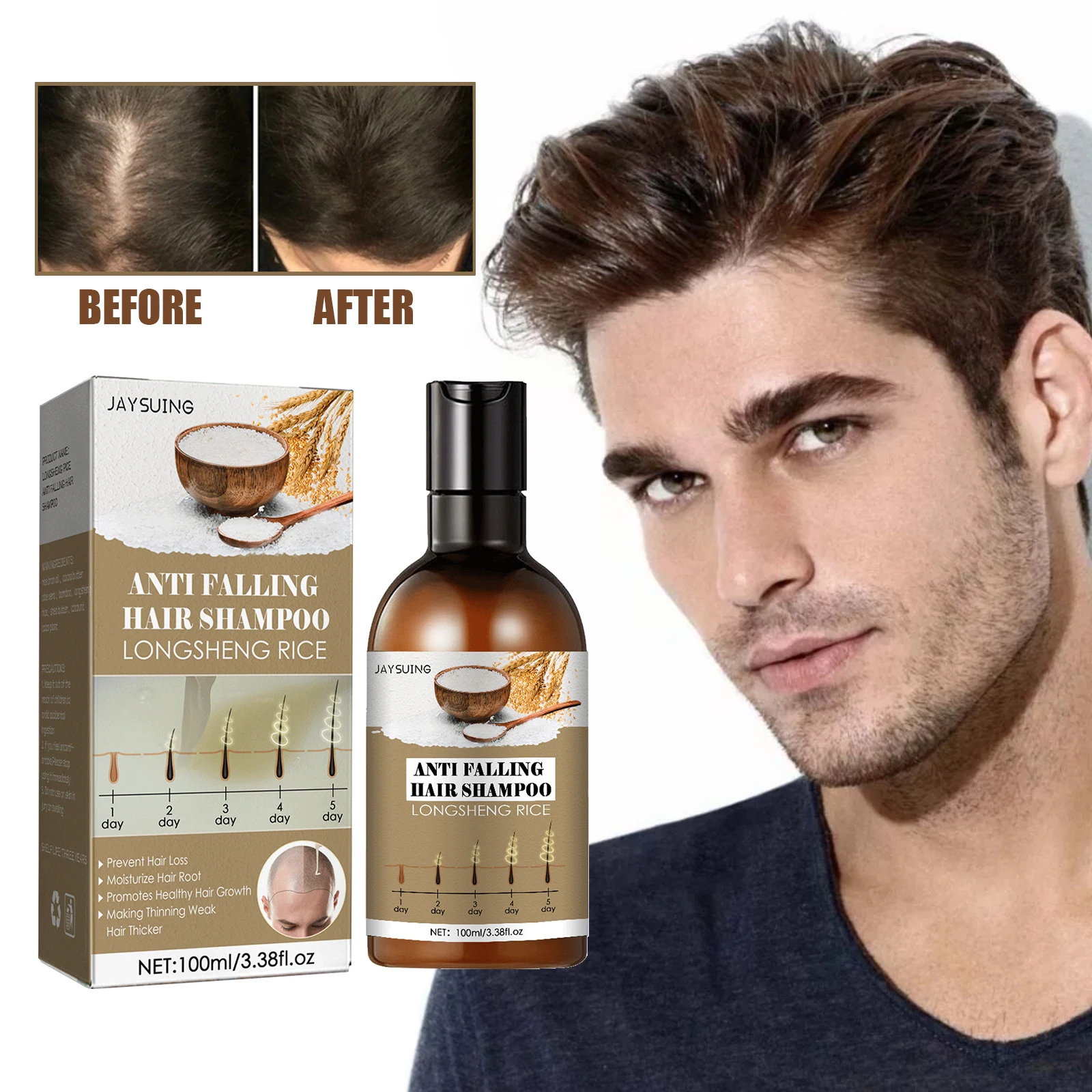 

Anti Hair Loss Shampoo Remove Dandruff Anti-itch Scalp Treatment Nourishing Repair Damaged Hair Care Regrowth Shampoo Men Women