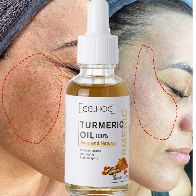 

Turmeric Whitening Freckles Serum Remove Dark Spots Melasma Brighten Lighten Melanin Improve Dull Anti-aging Face Skin Care