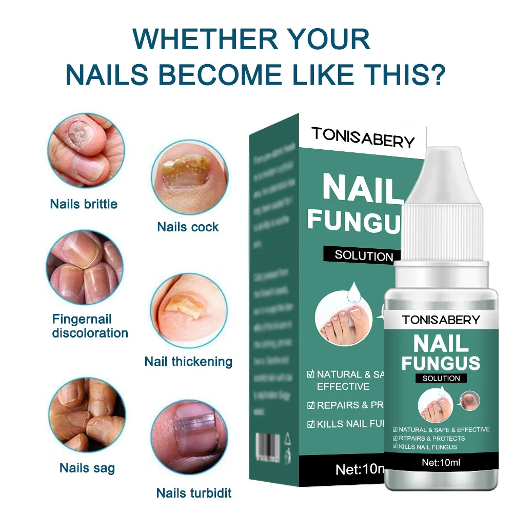 

10G/20G Nail Fungus Repair Nourishing Fluid Foot Care Serum Anti-Infective Paronychia Onychomycosis Nail Toe Fungus Removal Gel