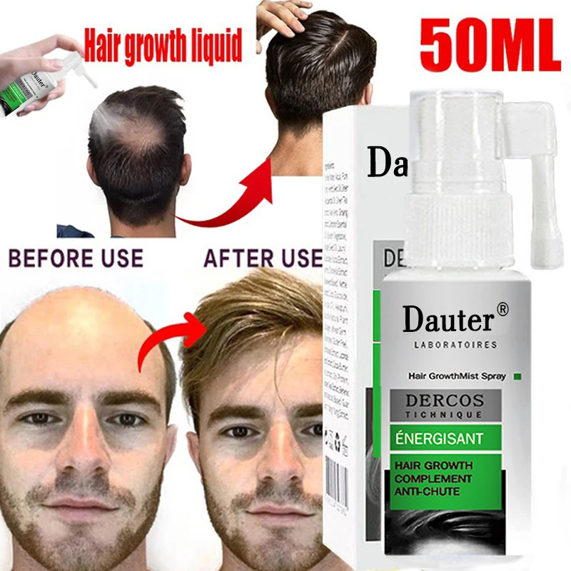 

Эссенция для быстрого и эффективного ухода за волосами, масло 50 мл/30 мл/20 мл/10 мл, жидкая терапия для предотвращения выпадения волос и эссенц...