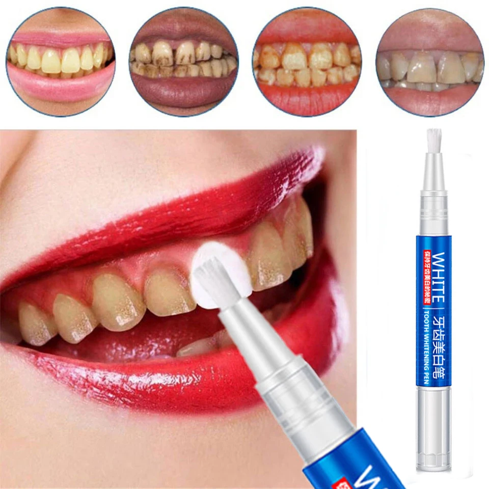

3ml Teeth Whitening Pen Tooth Gel Whitener Bleach Remove Stains Oral Hygiene Instant Smile Teeth Whitening Kit Cleaning Serum
