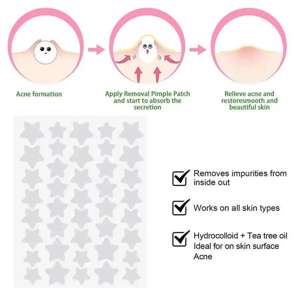 200 шт. водостойкие Патчи от акне