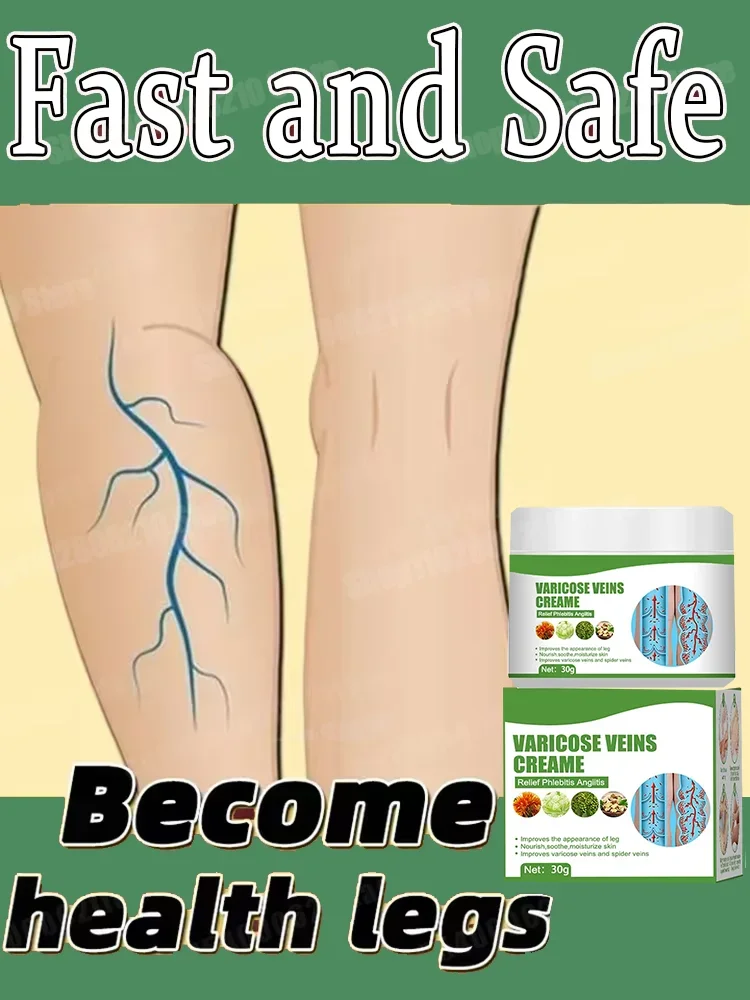 Крем от варикозного расширения вен снимает варикозное расширение улучшает