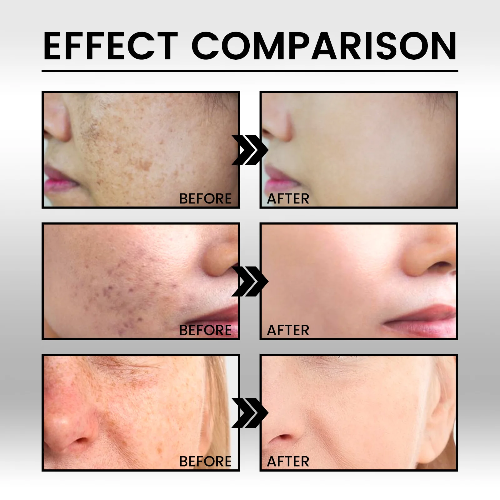 Сыворотка для лица с витамином C Niacinamide отбеливающий крем удаления веснушек