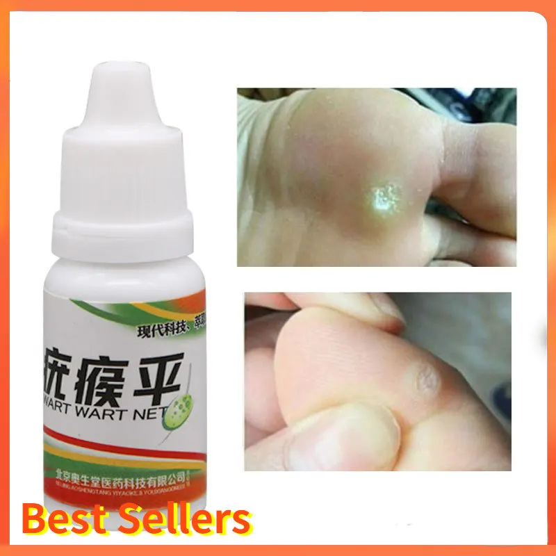 

12 Hours Black Dots Mole Wart Skin Tag Remover Liquid Medical Corn Removal Foot Genital Care Mole Removal Papillomas Treatment