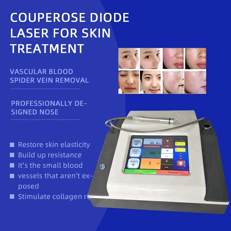 

Portable 980nm Diode Laser Vascular Spider Vein Removal Machine For Acne Treatment Red Vessel Skin Rejuvenation Beauty Device