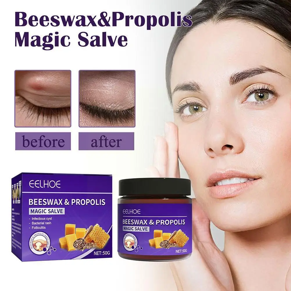 

Крем для удаления шрамов с прополисом, восстановление подкожных кусочков, восстановление влажного фолликула тела, снятие сетки, нежность кожи и волос F6G0