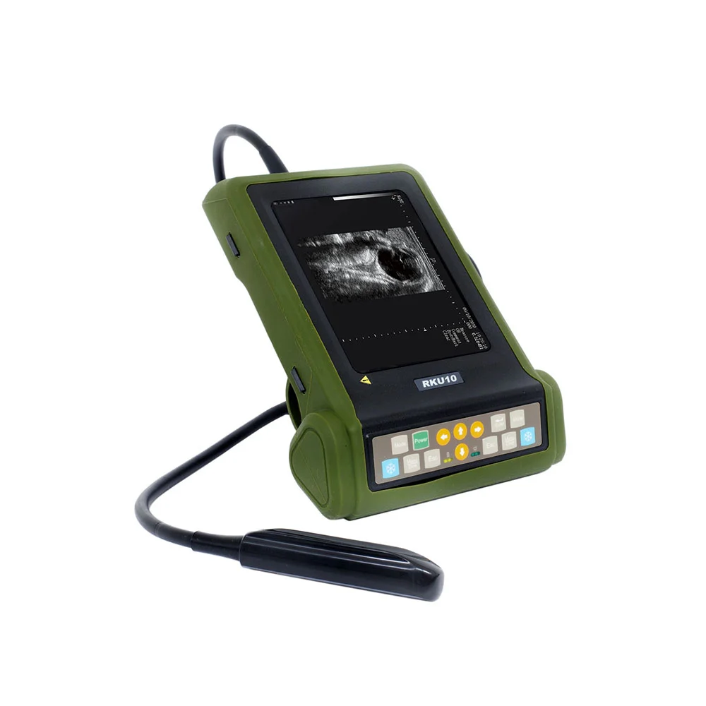 

Medco Equipment Handheld Ultrasound Machine Ultrasound Scanner