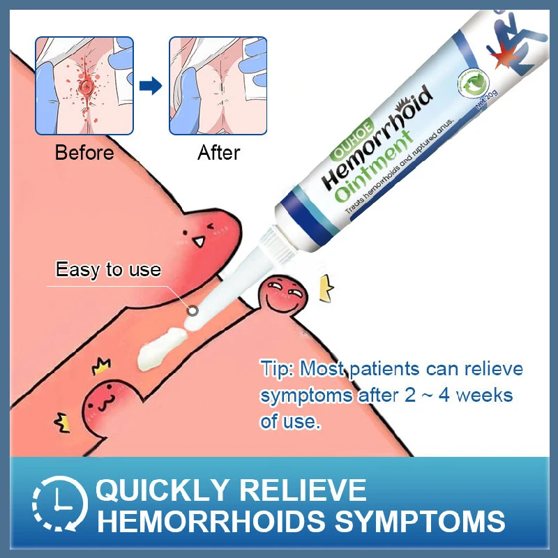 

Мазь от геморроя для эффективного лечения внутренней и внешней анальной трещины отеков, противоболезненный крем, натуральный травяной экстракт здоровья