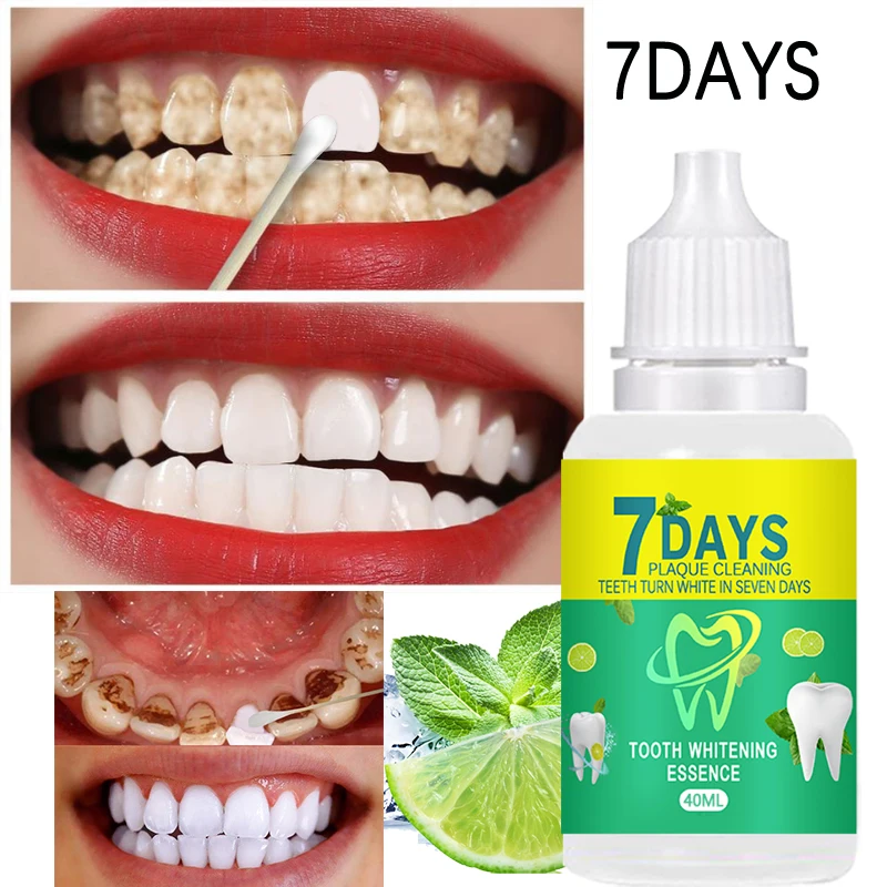 

Эссенция для отбеливания зубов на 7 дней, гигиена полости рта, эффективное удаление пятен зубного налета, инструмент для отбеливания желтых ...